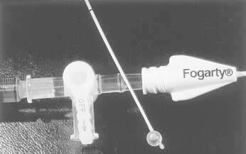 Fogarty导管及其连接装置（三通管）